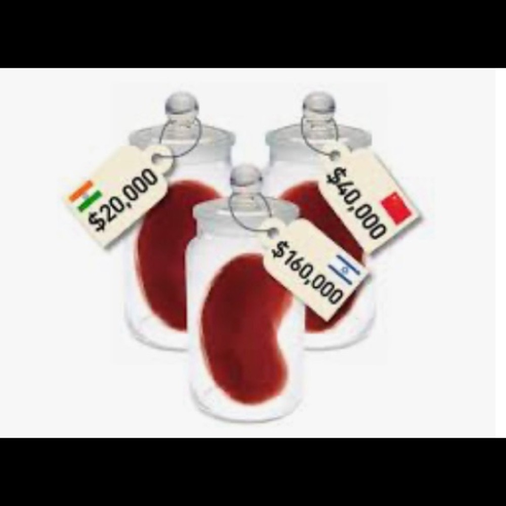 Kidney